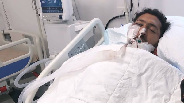 بعد 23 يوما على الحادث.. وفاة عامل الدليفري ضحية حادث التجمع