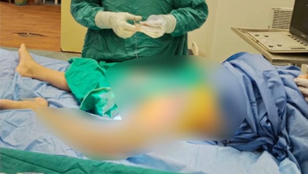عملية إنقاذ الطفل بمستشفى العامرية العام 