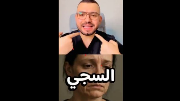 الخدود المترهلة والتجاعيد 