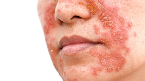  خاطر أدوات التجميل في العيد.. لا تضعي بشرتك على المحك 
