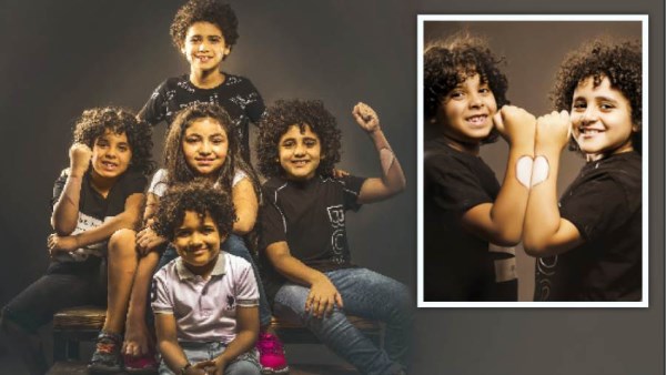 جلده مختلف لكنه جميل.. كيف أُهيئ طفلي المصاب بالبهاق لمواجهة المجتمع والتنمر بشجاعة؟  