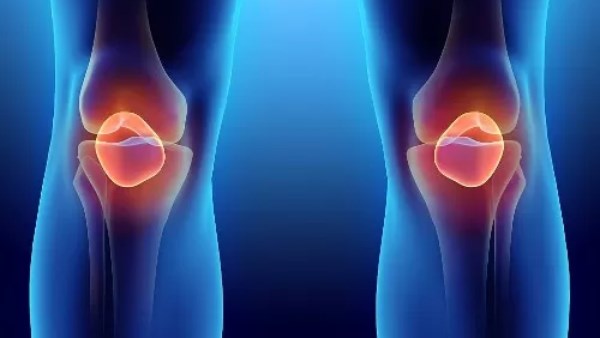 خلع الركبة إصابة خطيرة تهدد سلامة الساق بالكامل.. أسبابها وعلاجها؟