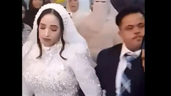 عريس متلازمة داون 