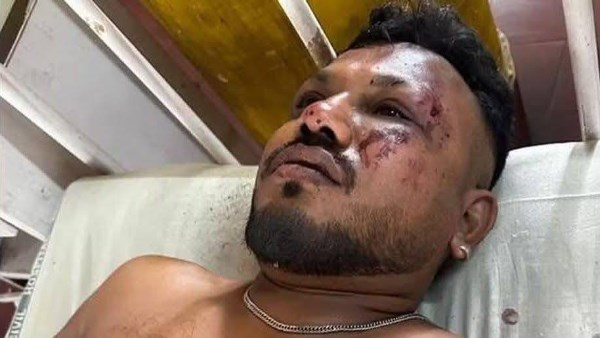 شاهد .. الناجي الوحيد من كارثة الطائرة الهندية