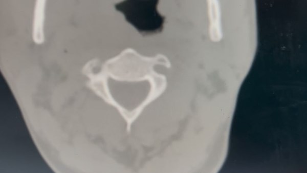 خراج كبير