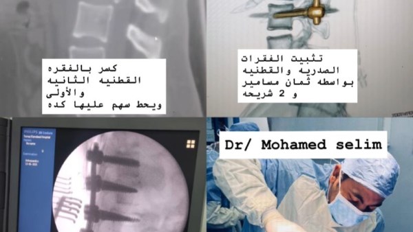 نجاح عمليات دقيقة