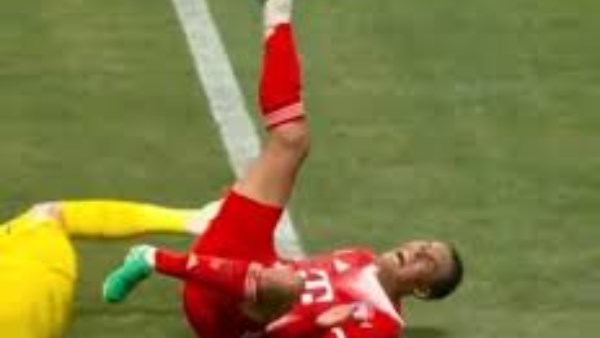 بعد التدخل المروع.. بايرن ميونخ يكشف تفاصيل إصابة جمال موسيالا