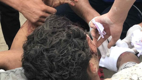 ننشر أسماء 20 مصابًا في حادث تصادم على طريق بورسعيد الإسماعيلية القديم