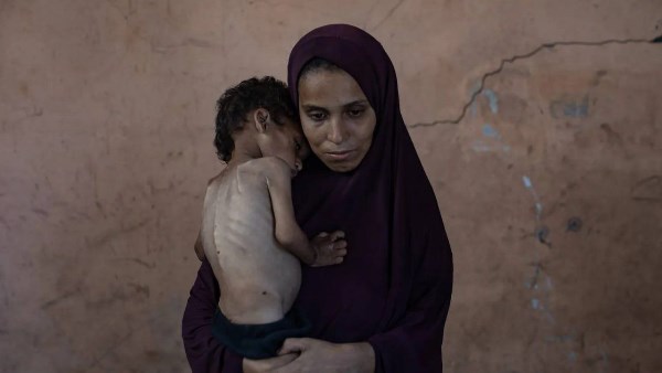 ام تحمل طفلها والجوع برى جسديهما في غزة 