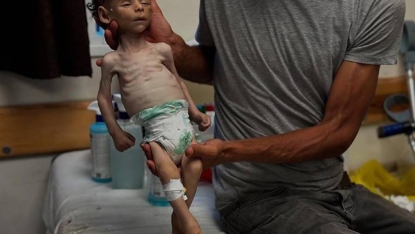شهداء بقصف للاحتلال في غزة.. والكثيرون اقتربوا من الموت بسبب المجاعة
