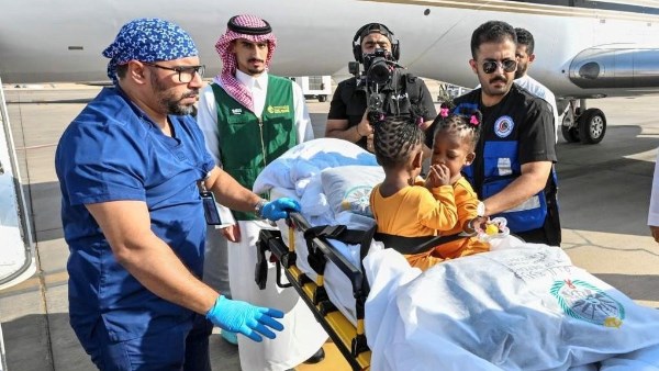 التوأم الملتصق