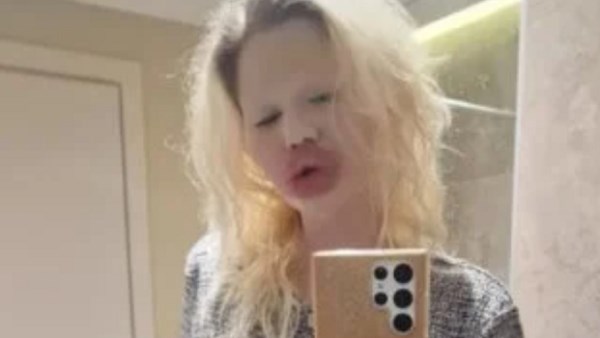 صاحبة أكبر شفاه في العالم.. أندريا إيفانوفا تكشف عن صورها قبل التجميل