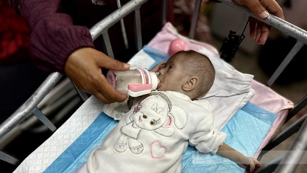المجاعة تشتد.. إحصائية صادمة عن الشهداء من الأطفال في غزة بسبب سوء التغذية