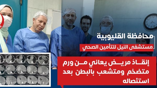 الفريق الطبي بمستشفى النيل للتأمين الصحي