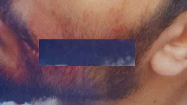 وجه الدكتور محمد بسيوني بعد الاعتداء عليه