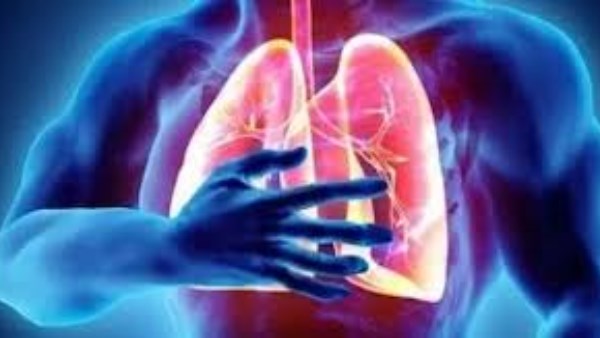 لا تتجاهل هذه العلامات.. قد تكون جلطة في الرئة وتهدد حياتك 