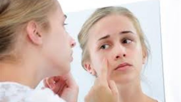 علامات ارتفاع الكوليسترول على الوجه