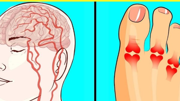 9 علامات تدل على نقص فيتامين د في جسمك