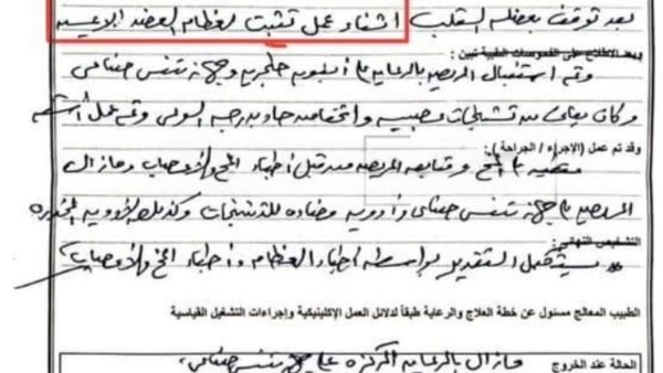 بورسعيد | التحقيق في واقعة توقف قلب شاب خلال عملية جراحية