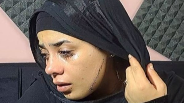 حكاية «منصورة» فتاة مصر القديمة.. طليقة عريسها شوهت وجهها والسبب «الغيرة»