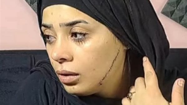المجني عليها 