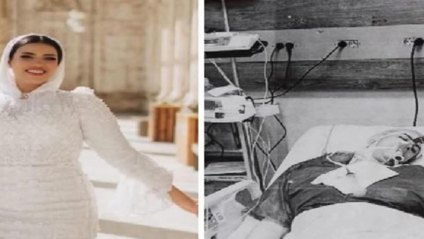 بعد وفاتها بسبب حقن تجميل.. تفاصيل التقرير الطبي لعروس حلوان