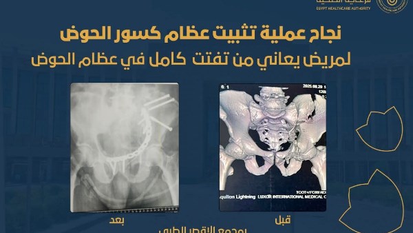 المجمع الطبي بالاقصر 