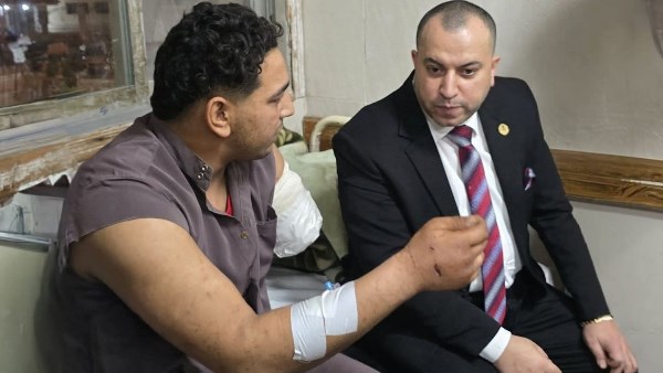 عامل السيرك المصاب بطنطا 