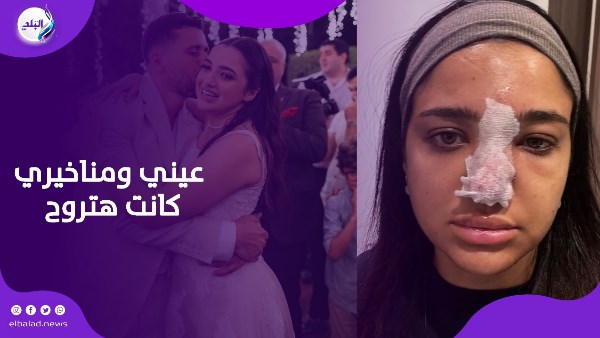 حقنة فيلر كانت هتضيع كنزي مدبولي