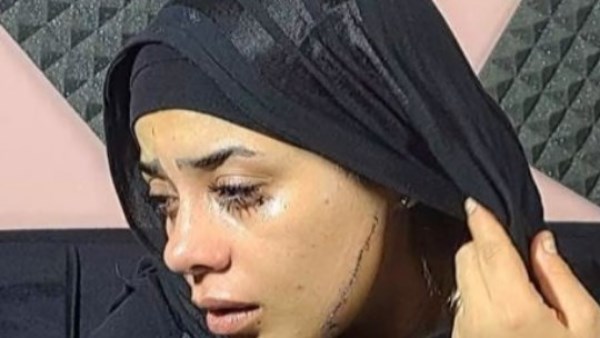 لو خدتها هندمك عليها وهحبسك.. عروس مصر القديمة تروي لحظات الرعب بعد تمزيف وجهها 