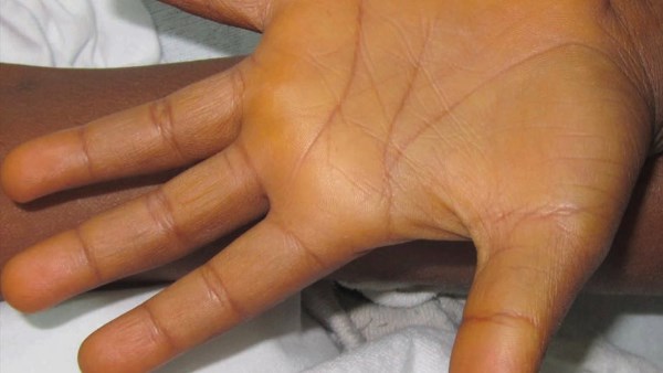 العملية التي تم إجراؤها