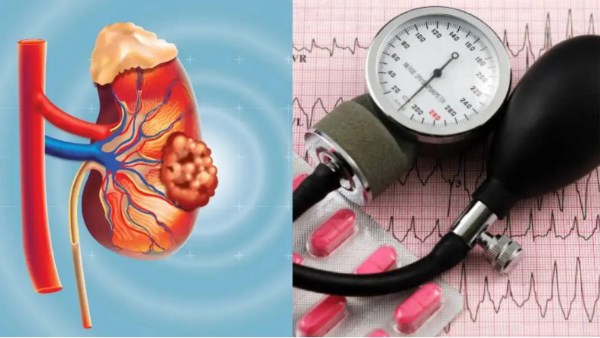 تحذير عاجل… ارتفاع ضغط الدم يصيبك بمرض مميت