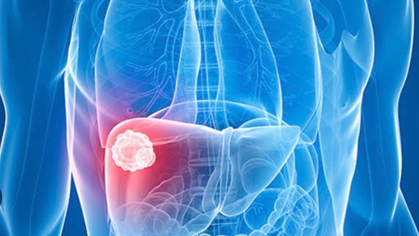 تحذير ..تناول هذه المشروبات والأطعمة يضر الكبد.. الأخيرة ستصدمك