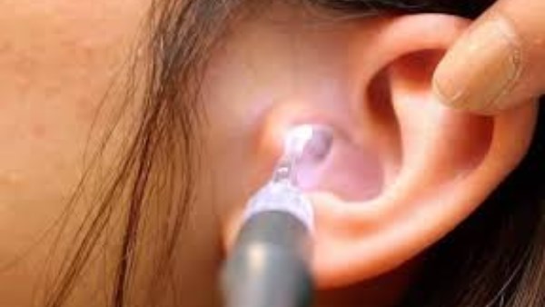 احترس من هذه العلامات الخطيرة لالتهاب الأذن الوسطى.. تجاهلها قد يهدد السمع 
