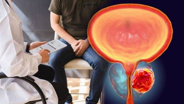 أطعمة مفيدة لصحة البروستاتا وأخرى تضر 