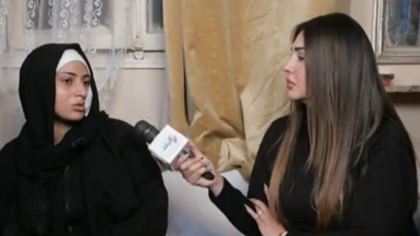 سيدة تكشف تفاصيل تعدي زوجها عليها وأصابها بـ 80 غرزة في وجهها