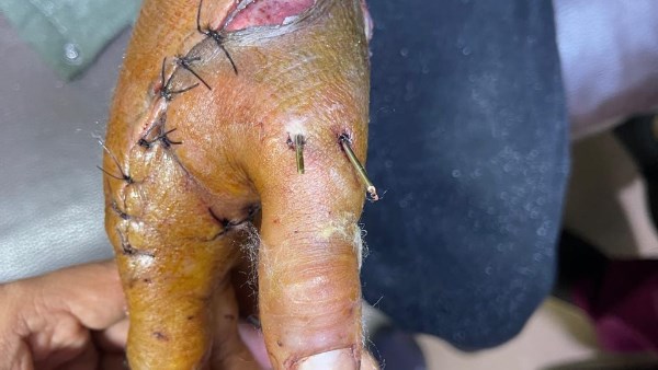 العملية التي تم إجراؤها