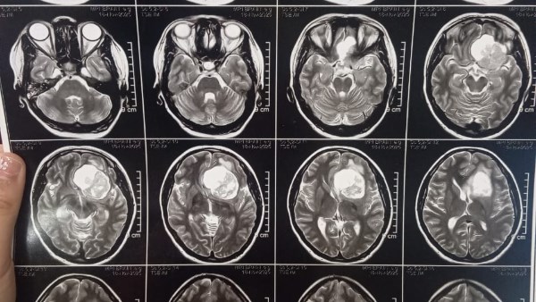 أشعة المريض