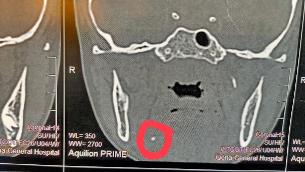 أشعة الطفل المريض 