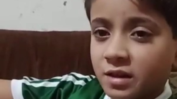 عقب التهام كلب لذراع طفل رعاية بورسعيد الصحية تقرر حجزه كاجراء احترازى 