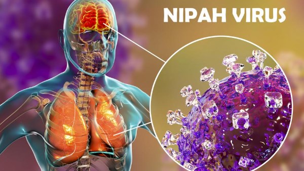 فيروس نيباه