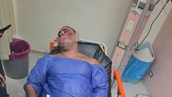 مدير الجيم المصاب