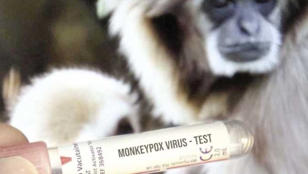 الكاميرون ترفع مستوى التأهب الصحي بسبب تفشي جدري القرود