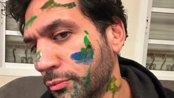 حسن الرداد يفاجئ جمهوره بفيديو طريف بعد رسومات نجله فادي على وجهه حسن الرداد يفاجئ جمهوره بفيديو طريف بعد رسومات نجله فادي على وجهه