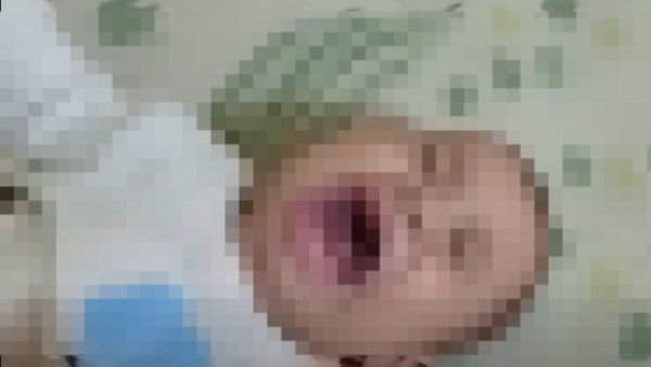 الطفل