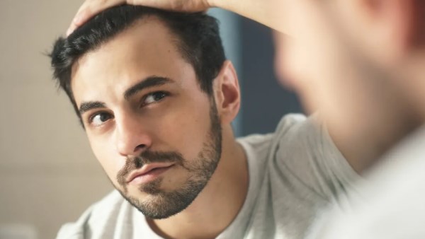  الوراثة أم التوتر؟ لهذه  الأسباب يتساقط شعر الرجال في سن مبكرة