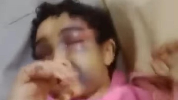الطفلة