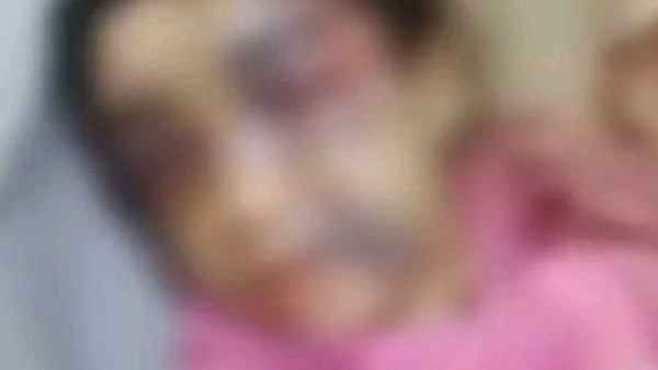 الطفلة منه ضحية والدها بالإسكندرية 