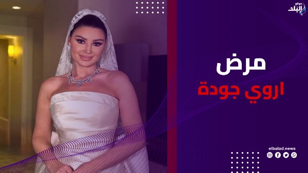 مرض اروي جودة