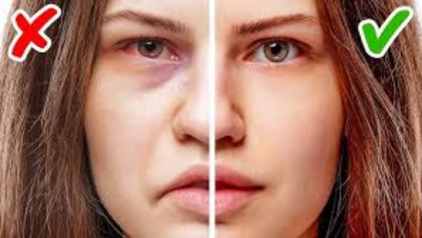 )لا تتجاهل هذا العرض في وجهك.. قد لا يكون تعبًا  